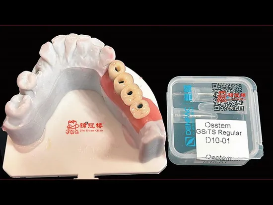 Dentale Sonderanfertigungen mit Präzision und Schnitt gefertigt